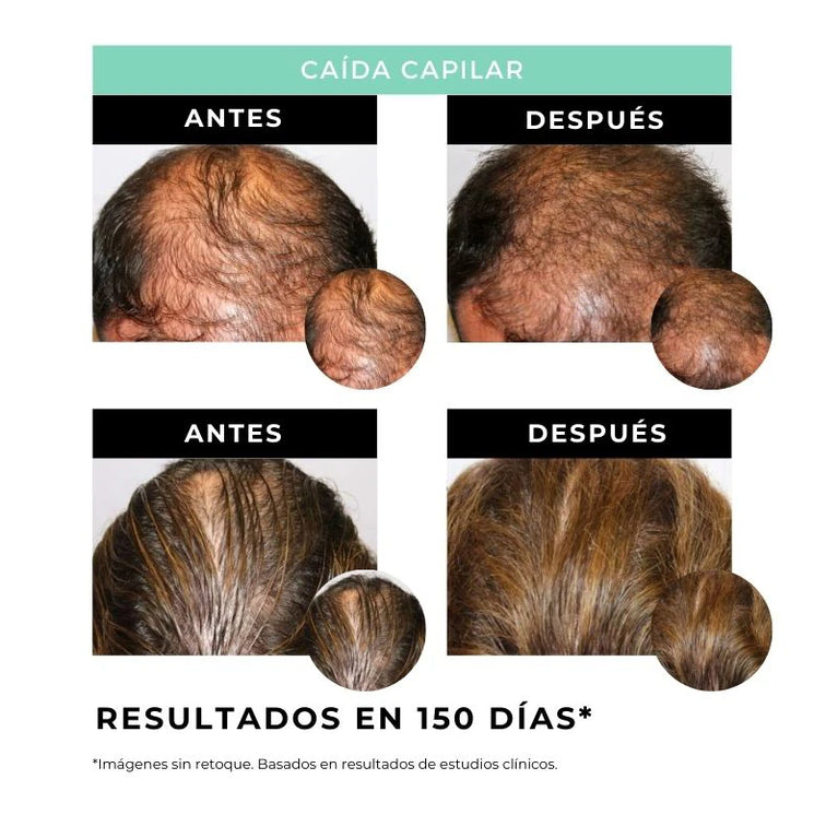 Strength - Sérum Fortalecedor del Cabello - Arganour